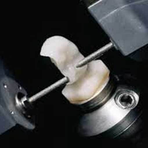 Cerec
